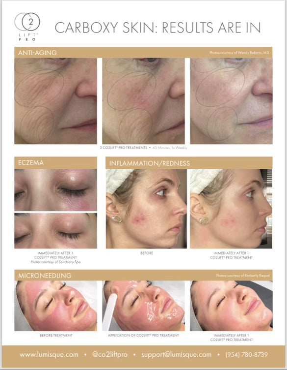 CO2 Lift Pro Carboxy Gel Treatment